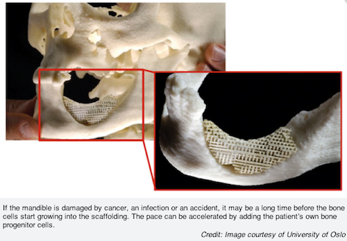 New Invention May Help the Body Generate New Bone Cody Lopez New Invention May Help The Body Generate New Bone Figure 1