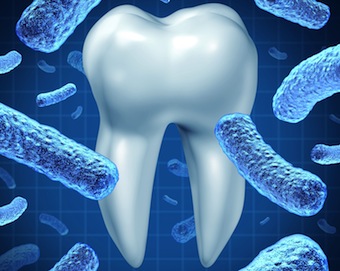 Research: Sequencing Harmless Oral Bacterium May Help To Unravel a Mystery Cody Lopez Sequencing Harmless Oral Bacterium May Help to Unravel a Mystery Featured Image
