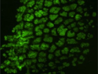 Study: Sponge-Like Gel May Steer Tooth and Tissue Formation Cody Lopez Sponge like Gel May Steer Tooth and Tissue Formation Featured Image