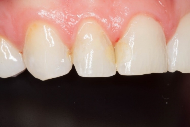 CourtneyLavigne the extended series of dental photographs Fig.10