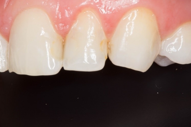 CourtneyLavigne the extended series of dental photographs Fig.11