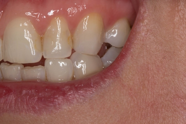 CourtneyLavigne the extended series of dental photographs Fig.12