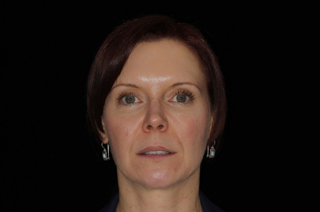 CourtneyLavigne the extended series of dental photographs Fig.2