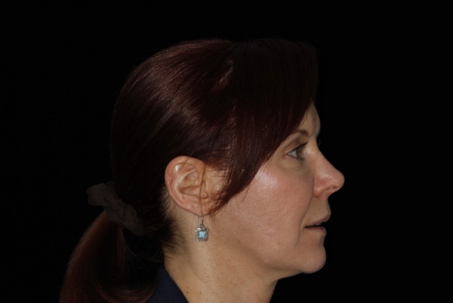 CourtneyLavigne the extended series of dental photographs Fig.4