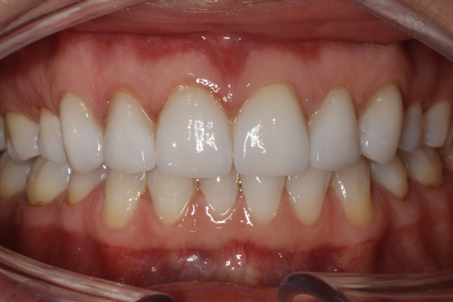 CourtneyLavigne the extended series of dental photographs Fig.5