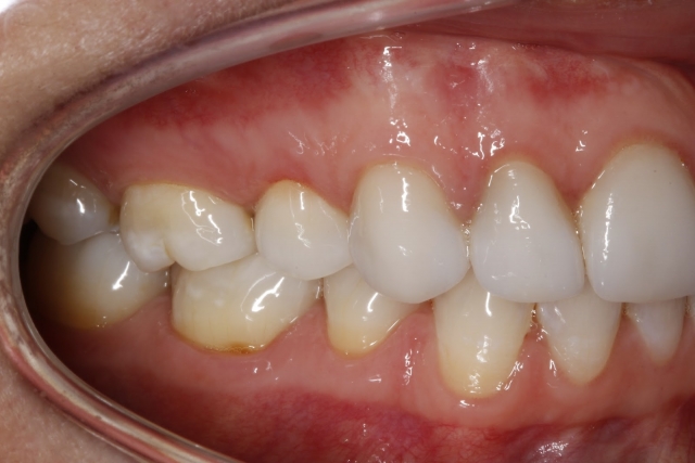 CourtneyLavigne the extended series of dental photographs Fig.7