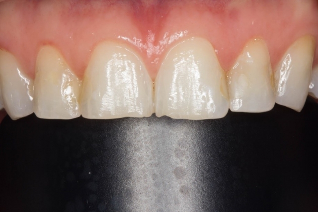 CourtneyLavigne the extended series of dental photographs Fig.8