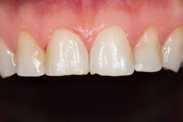 CourtneyLavigne the extended series of dental photographs Fig.9