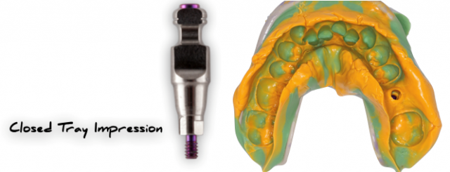 The Implant Working Cast: 4 Steps for Fabricating a Soft Tissue Cast Darin Dichter The Implant Working Cast Figure 5