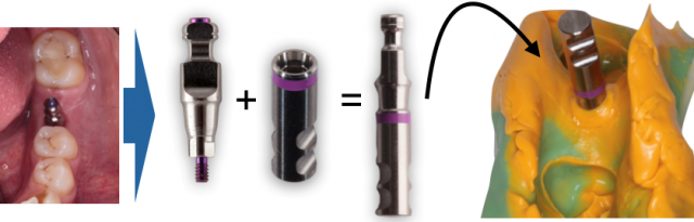 The Implant Working Cast: 4 Steps for Fabricating a Soft Tissue Cast Darin Dichter The Implant Working Cast Figure 7