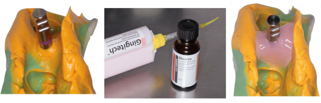 The Implant Working Cast: 4 Steps for Fabricating a Soft Tissue Cast Darin Dichter The Implant Working Cast Figure 8