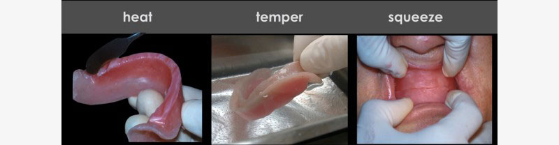 Occlusal Vertical Dimension and the Edentulous Patient: Methods for Recording OVD DarinDichter OccVertDimensionEndentulousPt Fig.2