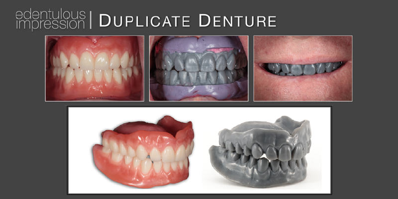 Options for Improving Clinical Efficiency When Fabricating New Removable Complete Dentures DarinDichter OptionsImprovingClinicalEffRemovableCompDenture Fig.6