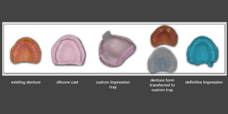 Options for Improving Clinical Efficiency When Fabricating New Removable Complete Dentures DarinDichter OptionsImprovingClinicalEffRemovableCompDenture Fig.9