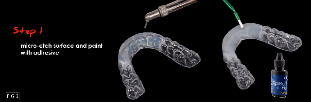 Modifying an Anterior Bite Plane With DURASPLINT LC DarinDichter modifying an anterior bite plane with durasplint Fig.3