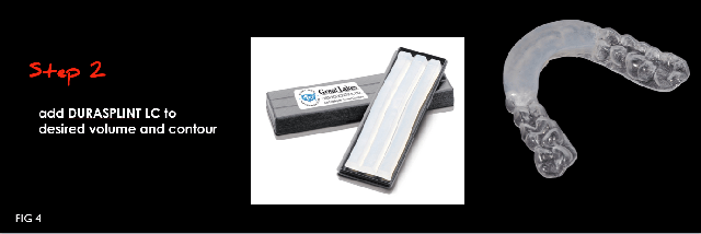 Modifying an Anterior Bite Plane With DURASPLINT LC DarinDichter modifying an anterior bite plane with durasplint Fig.4