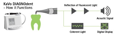 Caries Detection Tools: Select the Best for Your Practice Dave St. Ledger Caries Detection Tools Figure 3