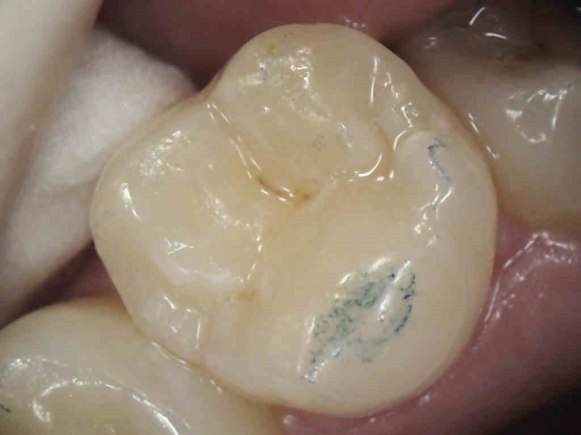 The Point of the First Point DaveStLedger the point of the first point Fig.1