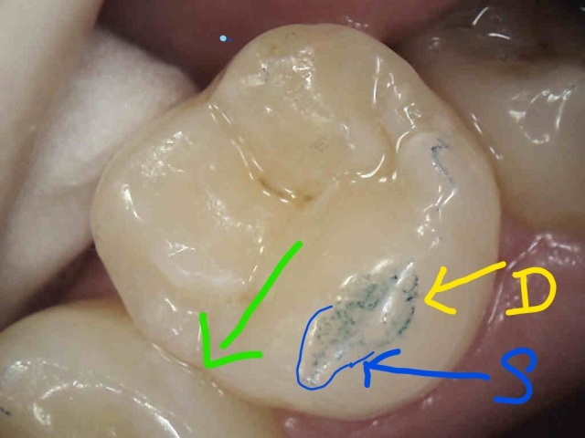 The Point of the First Point DaveStLedger the point of the first point Fig.2