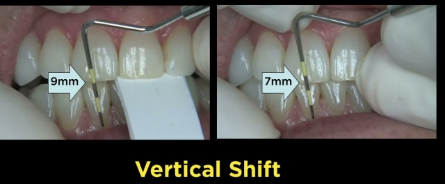 The Point of the First Point DaveStLedger the point of the first point Fig.4