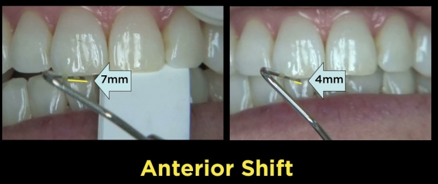 The Point of the First Point DaveStLedger the point of the first point Fig.5