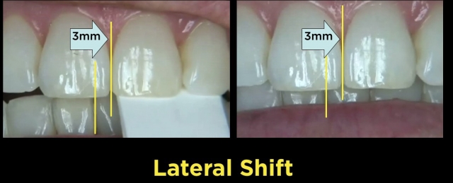 The Point of the First Point DaveStLedger the point of the first point Fig.6