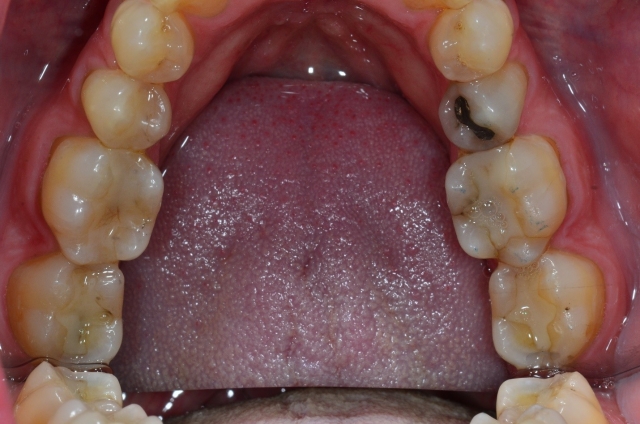 The Point of the First Point DaveStLedger the point of the first point Fig.7