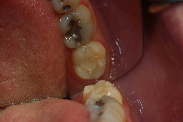 The Point of the First Point DaveStLedger the point of the first point Fig.8