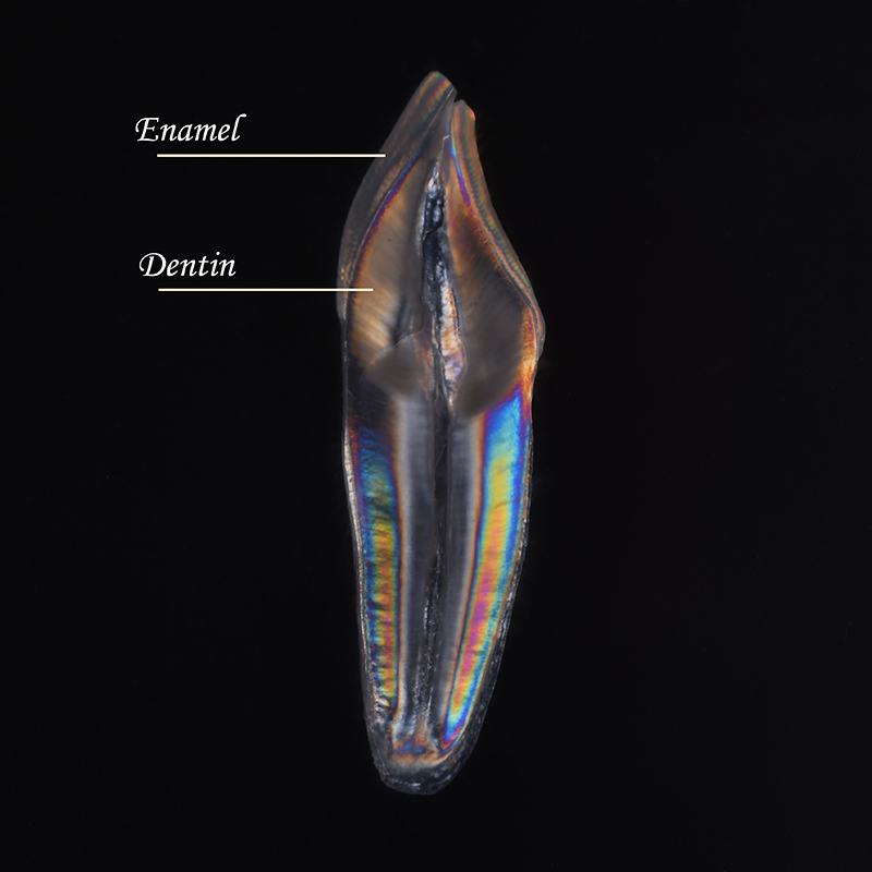 Basics of Layering Composites in the Esthetic Zone DawnWehking BasicsLayeringComposites Bonding Fig.2