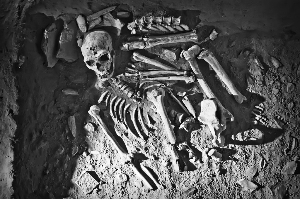 Study: Poisonous Weed Contributed to Sterling Oral Health of Ancient People Denise Prichard Poisonous Weed Contributed to Sterling Oral Health of Ancient People Featured Image