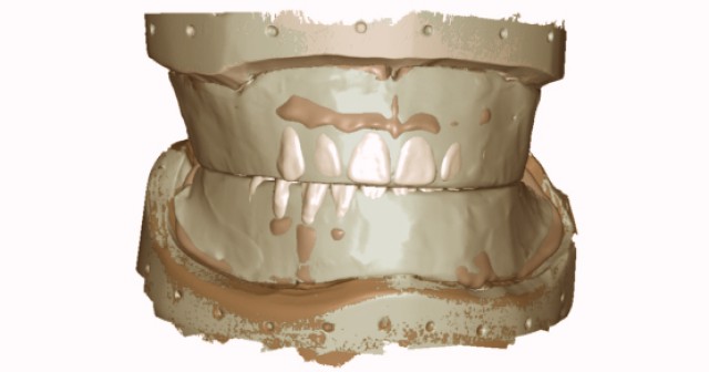 The Wax Rim Is As Important As Ever!