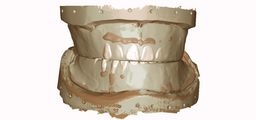 The Wax Rim Is As Important As Ever! Doug Benting Wax Rim Fig1