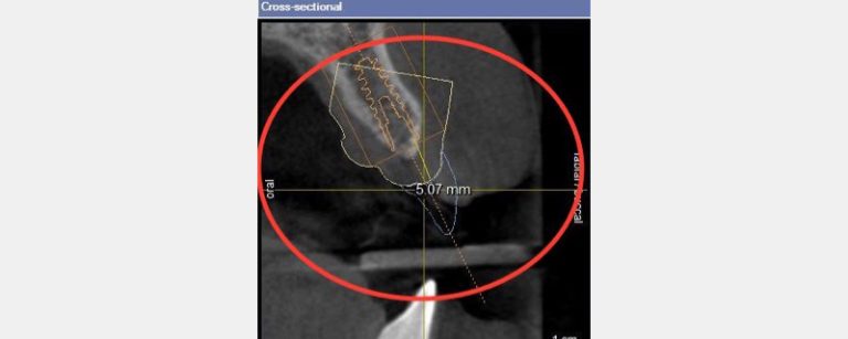 DougSmail how cbd can change surgical treatment planning Fig.1