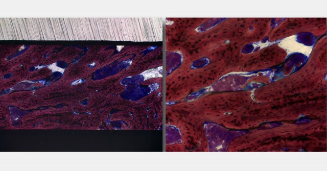 Spear Digest EToddScheyer modern periodontal regeneration advances in tissue engineering for improved clinical outcomes FetauredImages