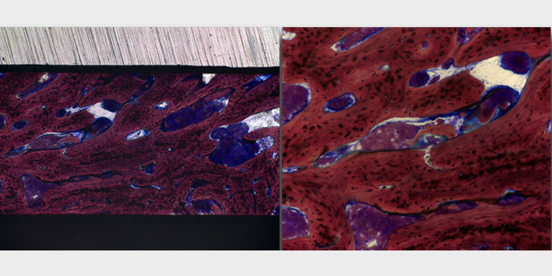 Modern Periodontal Regeneration: Advances in Tissue Engineering for Improved Clinical Outcomes EToddScheyer modern periodontal regeneration advances in tissue engineering for improved clinical outcomes Fig.5a 5b