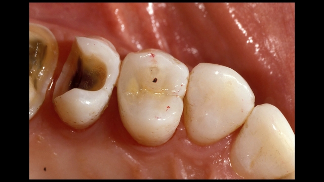 High Speed Brownie Points Frank Spear High Speed Brownie Points Figure 4