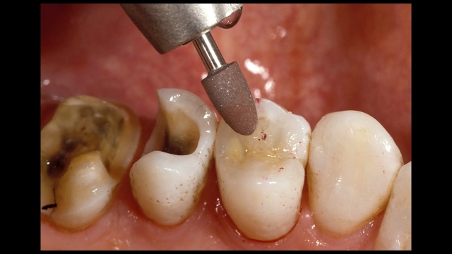 High Speed Brownie Points Frank Spear High Speed Brownie Points Figure 5