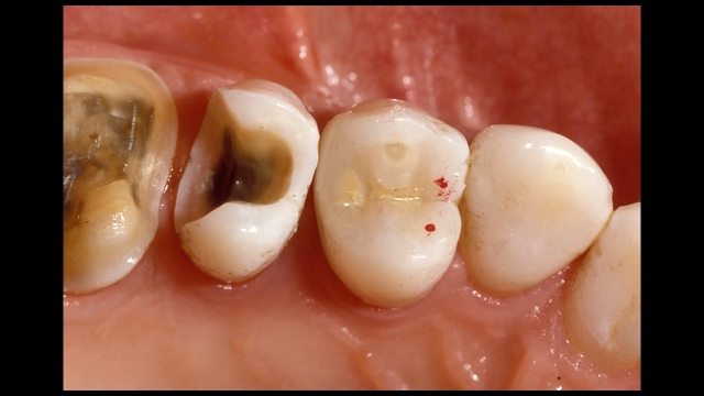 High Speed Brownie Points Frank Spear High Speed Brownie Points Figure 6