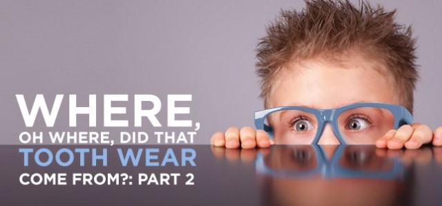 Where, Oh Where, Did That Tooth Wear Come From? Part 2 Freank Spear Where Oh Where Did That Tooth Wear Come From Part 2 Featured Image