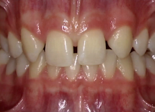 When Is Canine Substitution Appropriate? Gregg Kinzer When is Canine Substitution Appropriate Featured Image