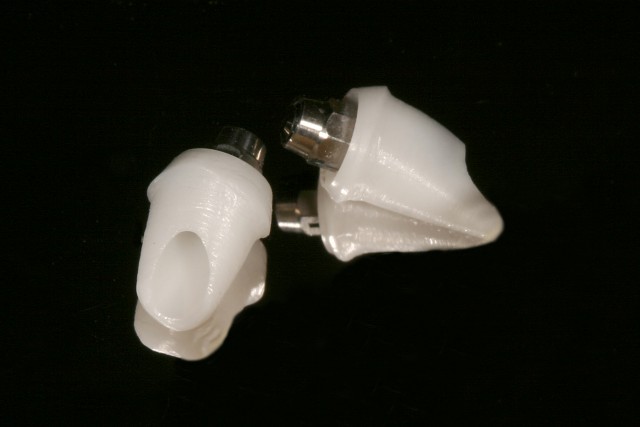 Greggory Kinzer How to Achieve Success with Custom Zirconia Abutments Featured Image