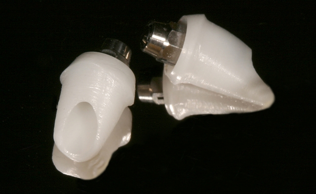 How to Achieve Success with Custom Zirconia Abutments Greggory Kinzer How to Achieve Success with Custom Zirconia Abutments Figure 3