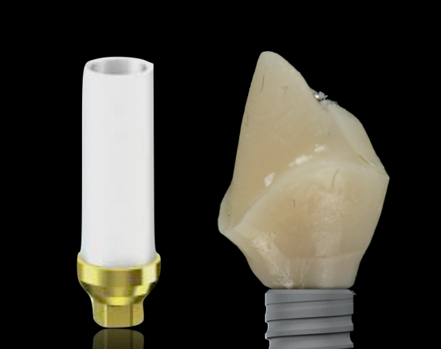 Greggory Kinzer The Abutment Option Most Dentists Overlook Featured Image