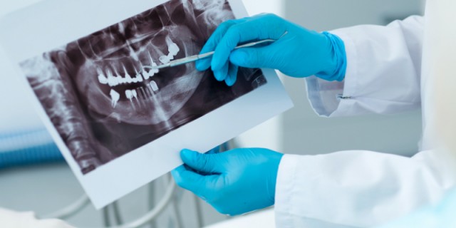 The 3 Accepts: Driving Case Acceptance in Urgent Times ImtiazManji the 3 accepts driving case acceptance in urgent times FeaturedImage