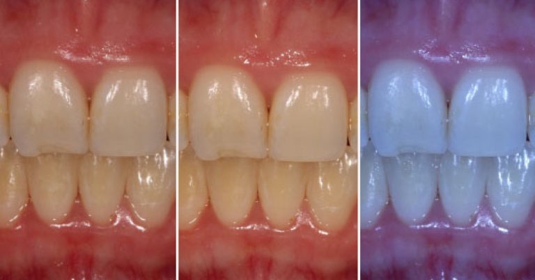The Importance of White Balance in Dental Photography