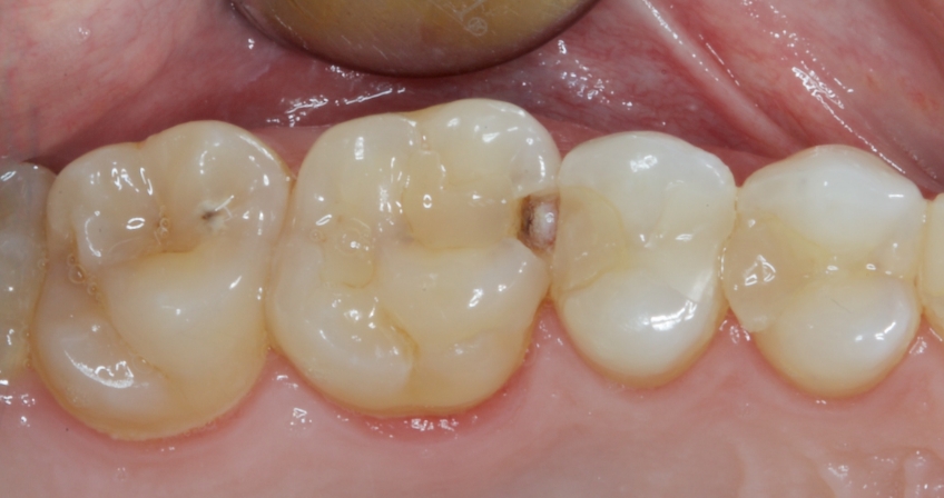 Jason Smithson Closing the Class 2 Restoration Box Part 2 Figure 1