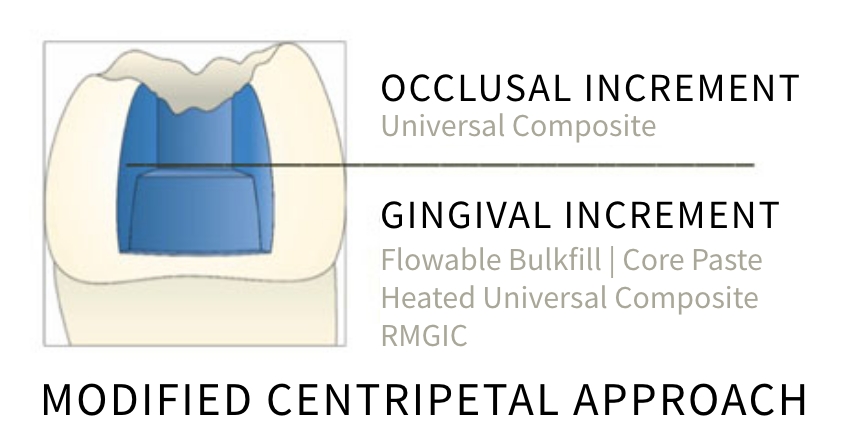 Jason Smithson Closing the Class 2 Restoration Box Part 2 Figure 12