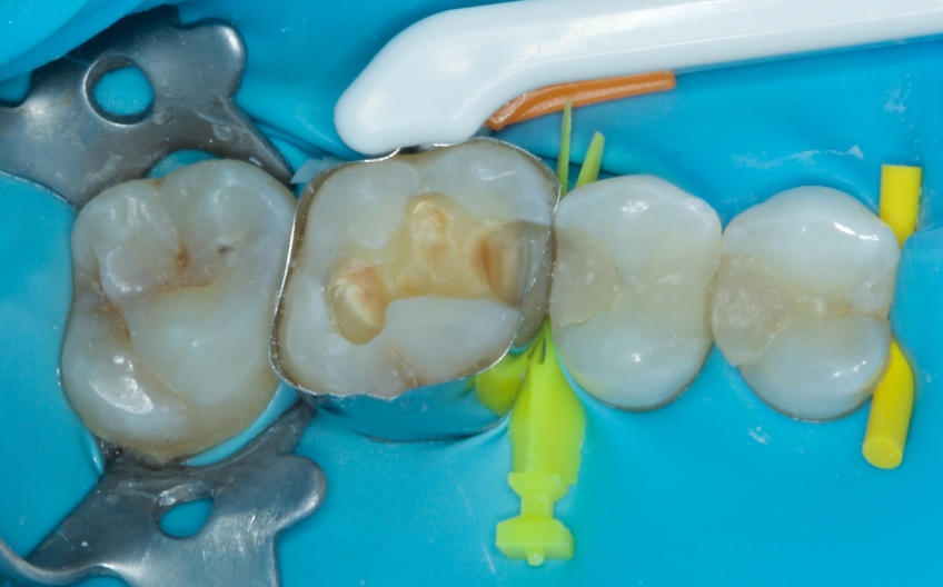Jason Smithson Closing the Class 2 Restoration Box Part 2 Figure 3