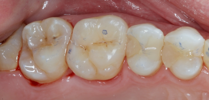 Jason Smithson Closing the Class 2 Restoration Box Part 2 Figure 5