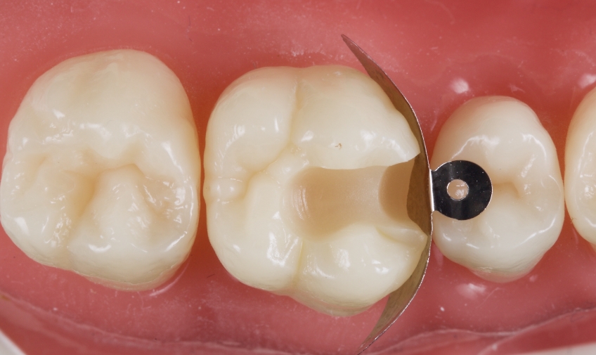 Jason Smithson Closing the Class 2 Restoration Box Part 2 Figure 6